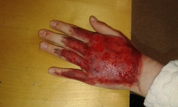 Valokuva maskeeeratusta verisestä kädestä