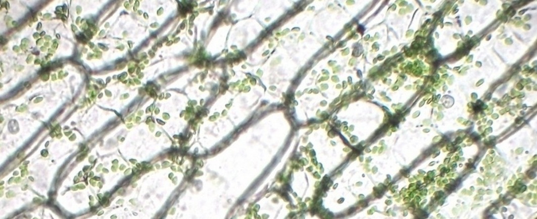 Chloroplasts in plant cells (microscopic image). The green chloroplasts are where photosynthesis takes place.