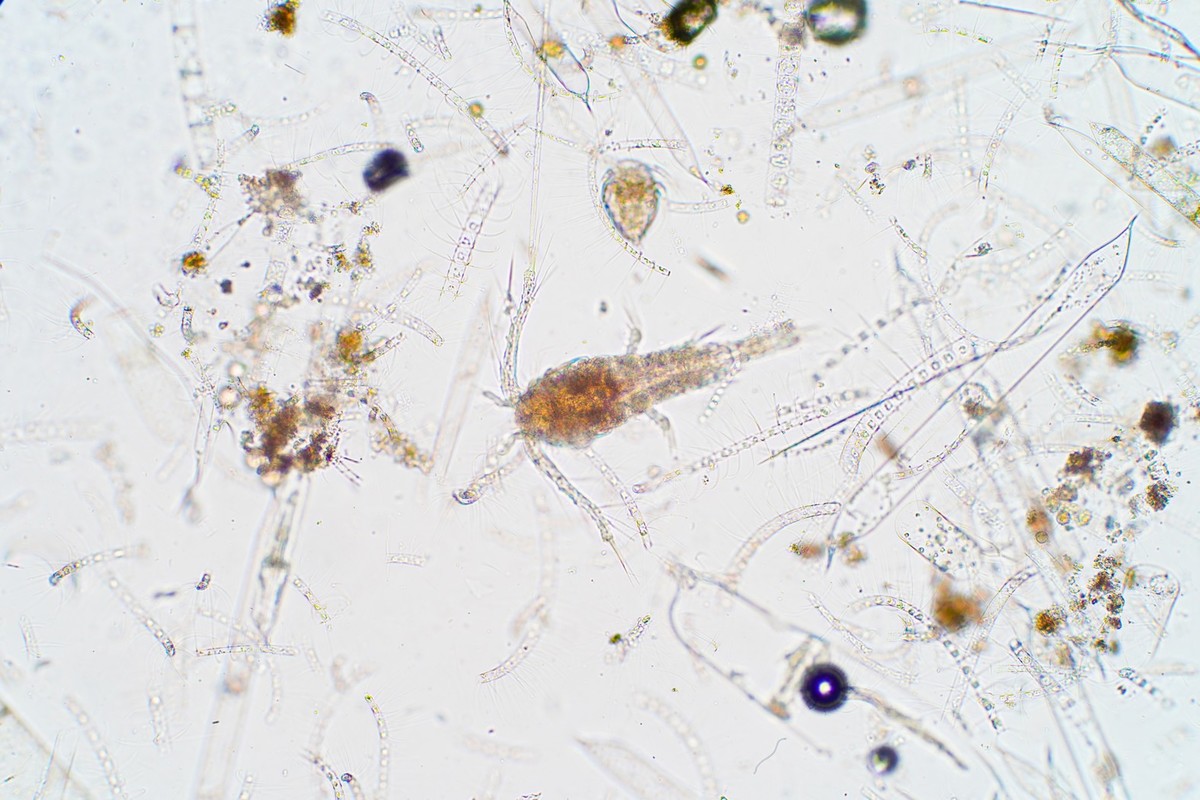 Marine aquatic plankton under the microscope view.