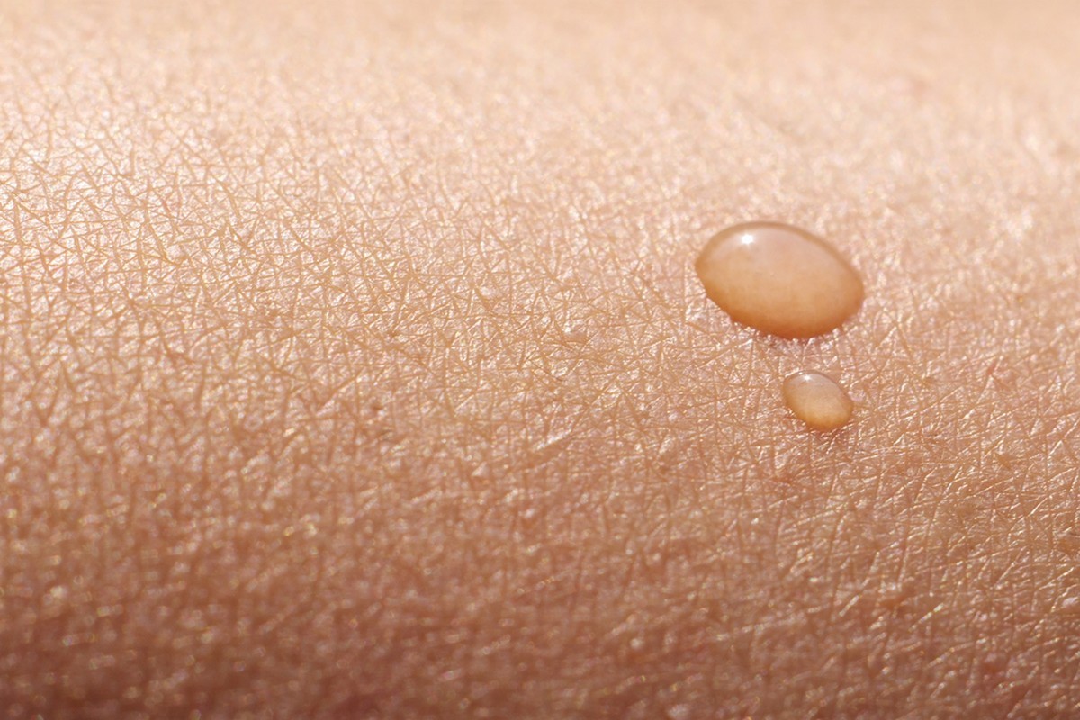 The skin protects your body from the outside world.